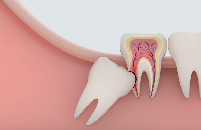 MYSA.ie - Sports Massage